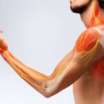 névralgie cervico-brachiale